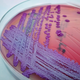 Colonies of Burkholderia pseudomallei in an agar plate.